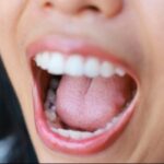 Foto ilustrasi (detikHealth)