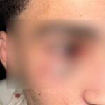 حوادث المجني عليه