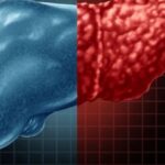 صحة وطب الكبد الدهني ـ تعبيرية