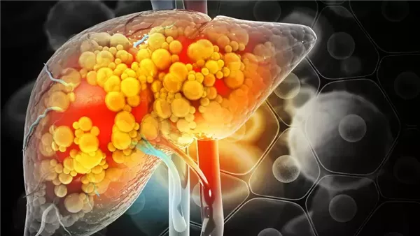 صحة وطب صورة تعبيرية