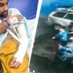 मारपीट में यात्री के हाथ में चोटें आईं. Photo ITG