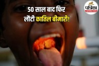 Diphtheria Outbreak Symptoms