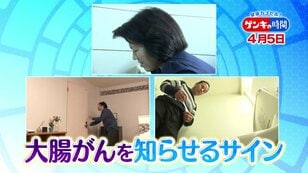 Signs of colorectal cancer: Key points for early detection of the most common cancer among Japanese people