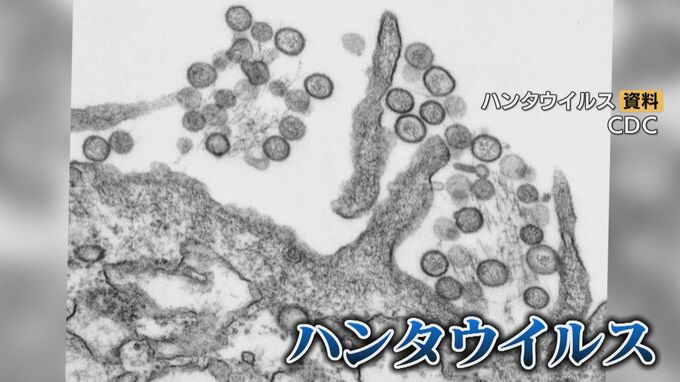 Questions about Hantavirus: How contagious is it? Is there a cure? Infections spreading on a cruise ship crossing the Atlantic.