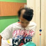 RM pemuda korban pembegalan sadis di kawasan Antapani, Kota Bandung, saat menjalani perawatan medis akibat luka bacok serius di bagian kepala. Selain melukai korban, pelaku juga membawa kabur sepeda motor dan uang tunai milik korban, Minggu (7/6) dini hari. (Tangkapan Layar)