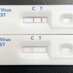 This photo shows a prototype rapid diagnostic kit for severe fever with thrombocytopenia syndrome. (SFTS). Kyodo)