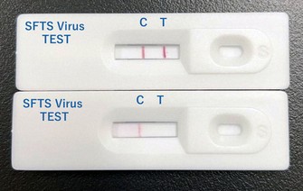 This photo shows a prototype rapid diagnostic kit for severe fever with thrombocytopenia syndrome. (SFTS). Kyodo)